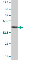Antibody Reactive Against Recombinant Protein.Western Blot detection against Immunogen (36.74 KDa) . 