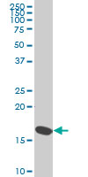 RPS23 monoclonal antibody (M02), clone 1E3 Western Blot analysis of RPS23 expression in HeLa ( (Cat # AT3715a )