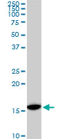 RPS23 monoclonal antibody (M02), clone 1E3. Western Blot analysis of RPS23 expression in NIH/3T3((Cat # AT3715a )