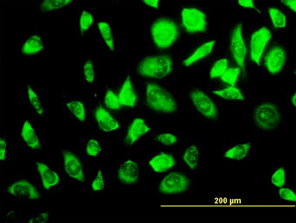 Immunofluorescence of monoclonal antibody to RPS23 on HeLa cell. [antibody concentration 10 ug/ml]