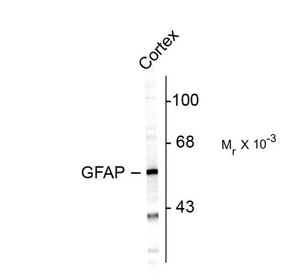 Western blot of rat cortex lysate showing specific immunolabeling of the ~ 50k GFAP protein.