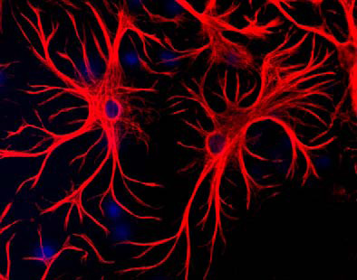 Mixed cultures of neurons and glia stained with chicken anti-GFAP (red), and DNA (blue).Astrocytes stain strongly and specifically in a clearly filamentous fashion with this antibody.