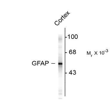 Western blot of rat cortex lysate showing specific immunolabeling of the ~ 50k GFAP protein.