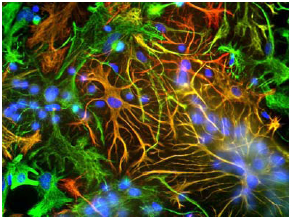 Immunofluorescence showing specific labeling of GFAP (red) and vimentin (green) in cultured neurons and glia. Cells containing GFAP and vimentin appear yellow.