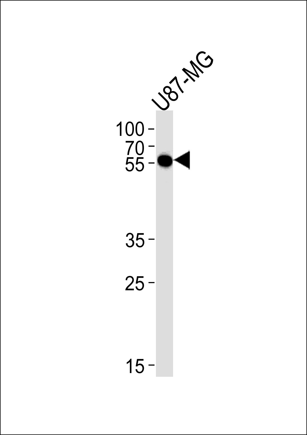 CMAS Antibody (C-term) (Cat. #AP20526b) western blot analysis in U87-MG cell line lysates (35ug/lane).This demonstrates the CMAS antibody detected the CMAS protein (arrow).