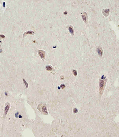 Immunohistochemical analysis of paraffin-embedded H.brain section using C13orf30 Antibody (C-term)(Cat#AP20605c). AP20605c was diluted at 1:25 dilution. A peroxidase-conjugated goat anti-rabbit IgG at 1:400 dilution was used as the secondary antibody, followed by DAB staining.