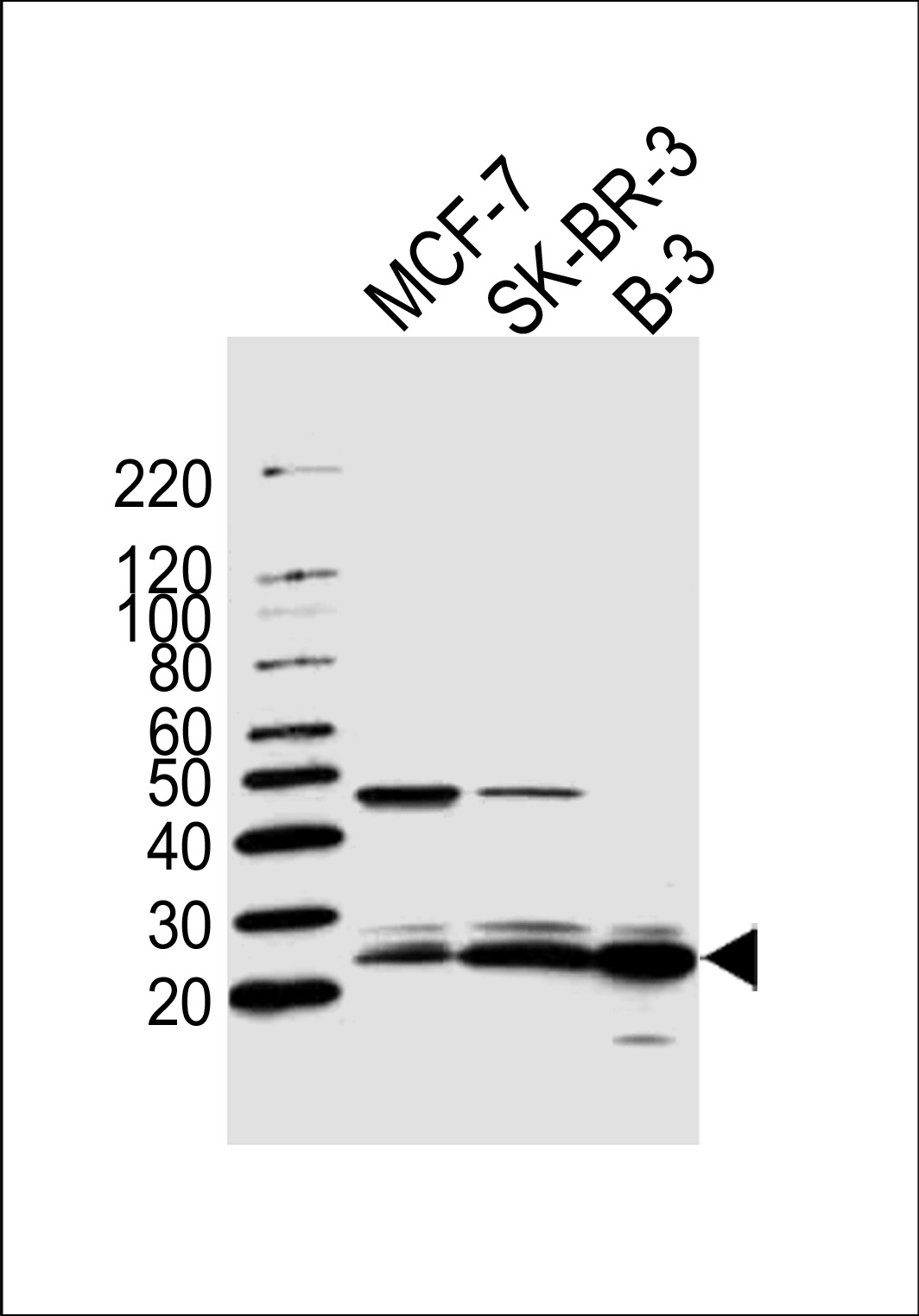 Western blot analysis of lysates from MCF-7, SK-BR-3, B-3 cell line (from left to right), using C13orf30 Antibody (C-term)(Cat. #AP20605c). AP20605c was diluted at 1:1000 at each lane. A goat anti-rabbit IgG H&L(HRP) at 1:5000 dilution was used as the secondary antibody. Lysates at 35ug per lane.