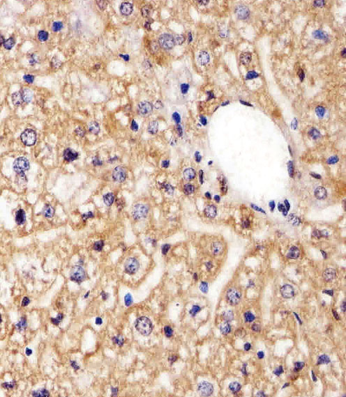 Immunohistochemical analysis of paraffin-embedded M. liver section using AGAP8 Antibody (C-term)(Cat#AP20603c). AP20603c was diluted at 1:25 dilution. A peroxidase-conjugated goat anti-rabbit IgG at 1:400 dilution was used as the secondary antibody, followed by DAB staining.
