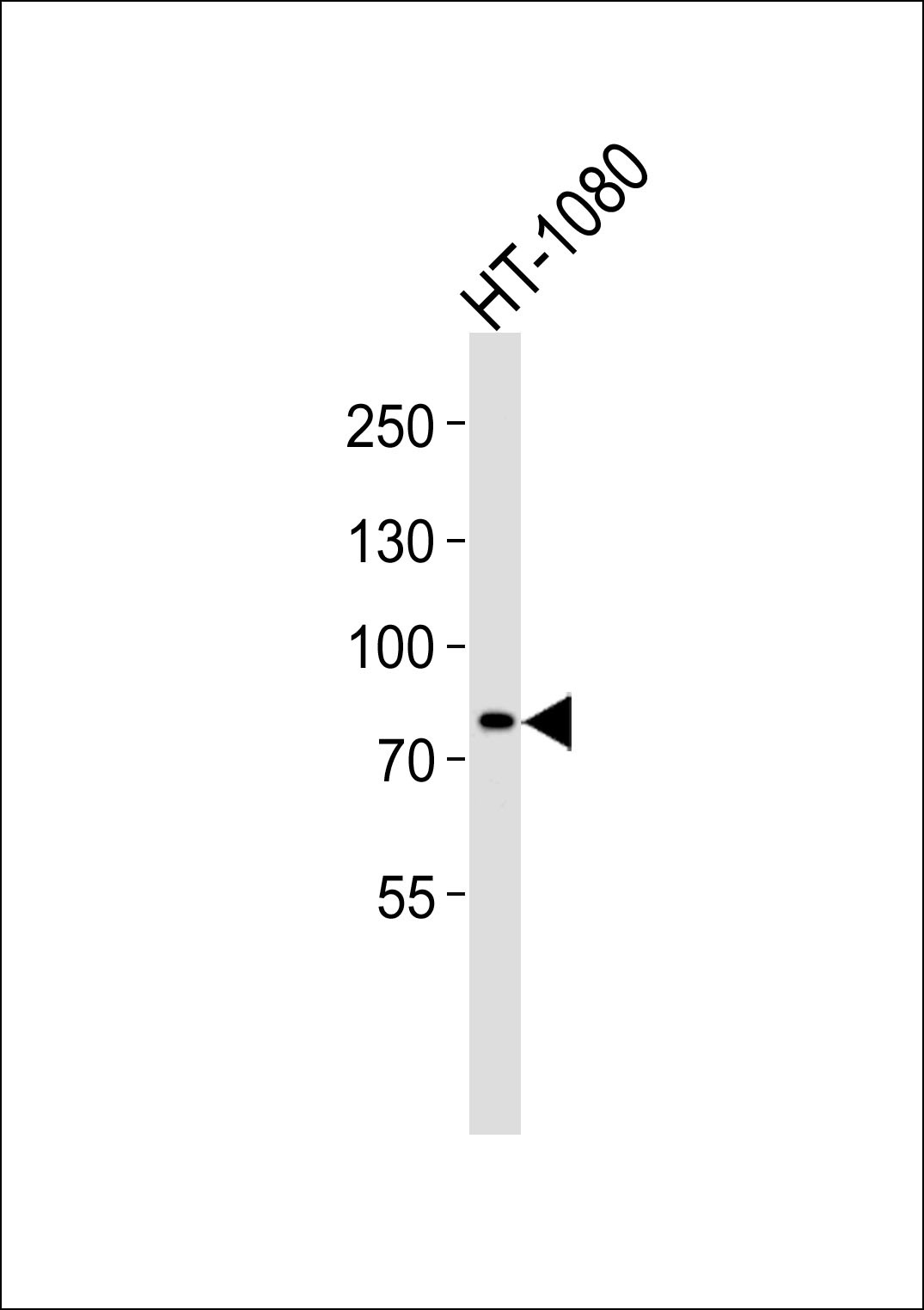 Western blot analysis of lysate from HT-1080 cell line, using AGAP8 Antibody (C-term)(Cat. # AP20603c). AP20603c was diluted at 1:1000. A goat anti-rabbit IgG H&L(HRP) at 1:5000 dilution was used as the secondary antibody. Lysate at 35ug.