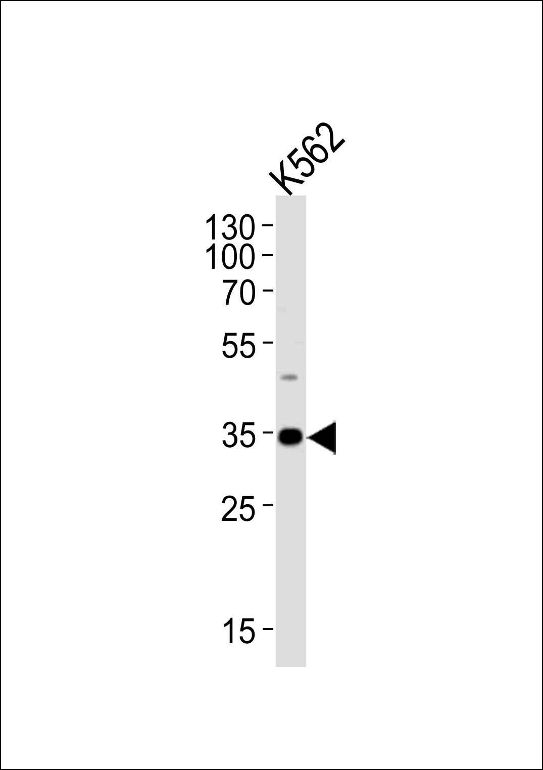 Western blot analysis of lysate from K562 cell line, using BBS5 Antibody (Center)(Cat. #AP20560a). AP20560a was diluted at 1:1000. A goat anti-rabbit IgG H&L(HRP) at 1:5000 dilution was used as the secondary antibody. Lysate at 35ug.