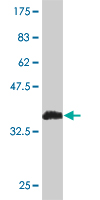 Antibody Reactive Against Recombinant Protein.Western Blot detection against Immunogen (36.74 KDa) . 