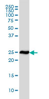 RPL19 monoclonal antibody (M01), clone 3H4 Western Blot analysis of RPL19 expression in HeLa ( (Cat # AT3704a )