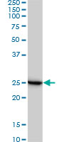 RPL19 monoclonal antibody (M01), clone 3H4. Western Blot analysis of RPL19 expression in Jurkat ( (Cat # AT3704a )