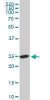 RPL19 monoclonal antibody (M01), clone 3H4. Western Blot analysis of RPL19 expression in NIH/3T3 ( (Cat # AT3704a )