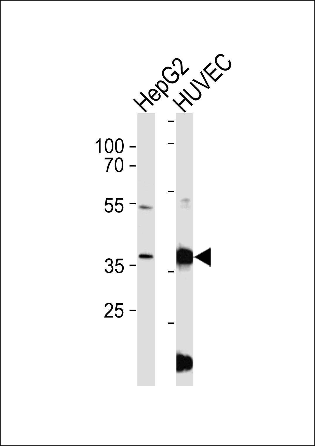 Western blot analysis of lysates from HepG2,HUVEC cell line (from left to right),using B3GALT1 Antibody(C14712). C14712 was diluted at 1:1000 at each lane. A goat anti-rabbit IgG H&L(HRP) at 1:5000 dilution was used as the secondary antibody.Lysates at 35ug per lane.
