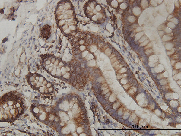 Immunoperoxidase of monoclonal antibody to RPL19 on formalin-fixed paraffin-embedded human small Intestine tissue. [antibody concentration 1 ~ 10 ug/ml]