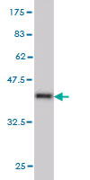 Antibody Reactive Against Recombinant Protein.Western Blot detection against Immunogen (36.74 KDa) . 