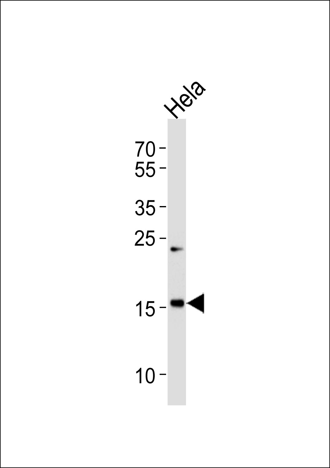 Western blot analysis of lysates from Hela cell line ,using MYL7 Antibody(C20920). C20920 was diluted at 1:1000. A goat anti-rabbit IgG H&L(HRP) at 1:5000 dilution was used as the secondary antibody.Lysates at 35ug.