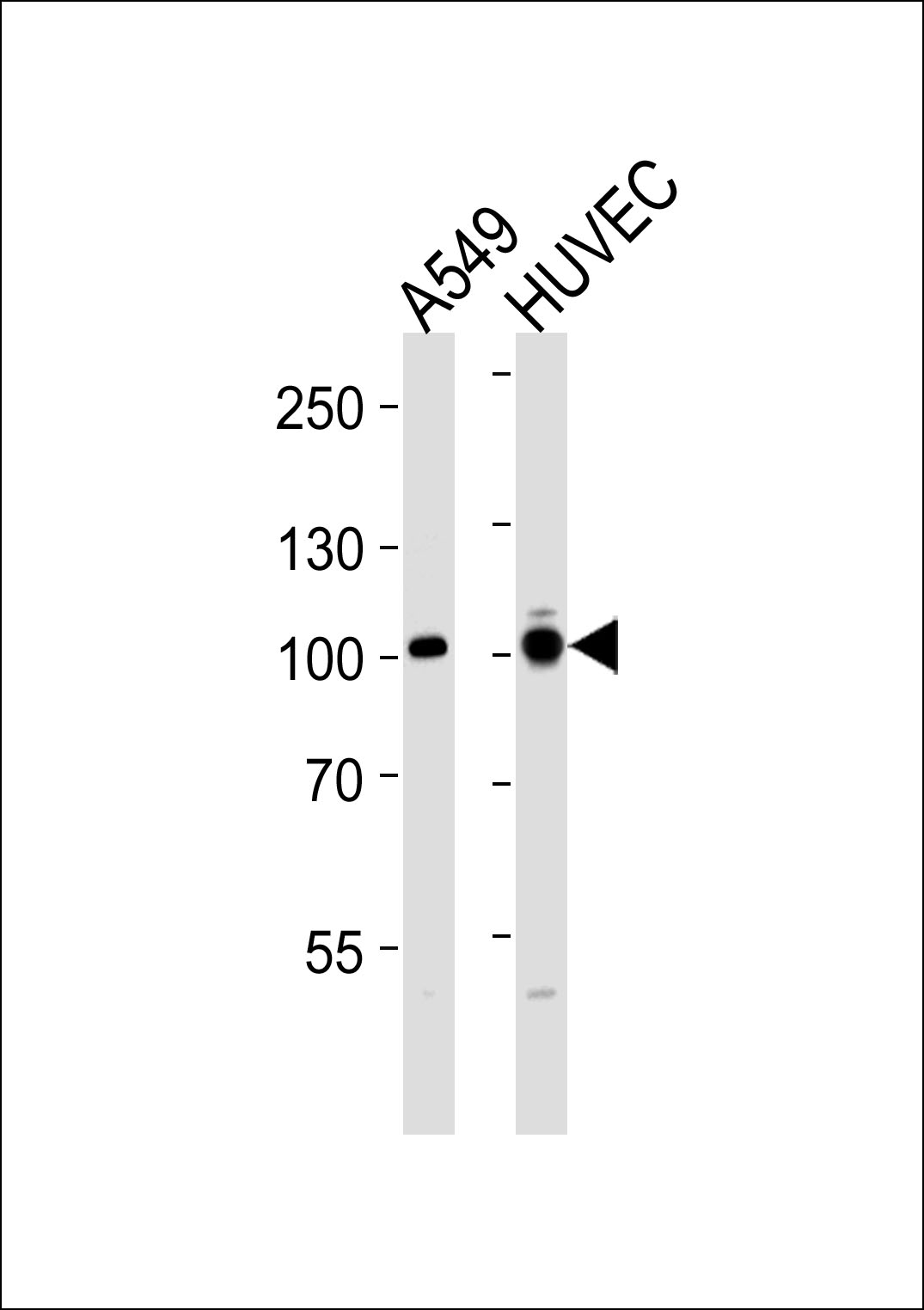 Western blot analysis of lysates from A549,HUVEC cell line (from left to right),using ADCY9 Antibody(C20506). C20506 was diluted at 1:1000 at each lane. A goat anti-rabbit IgG H&L(HRP) at 1:5000 dilution was used as the secondary antibody.Lysates at 35ug per lane.