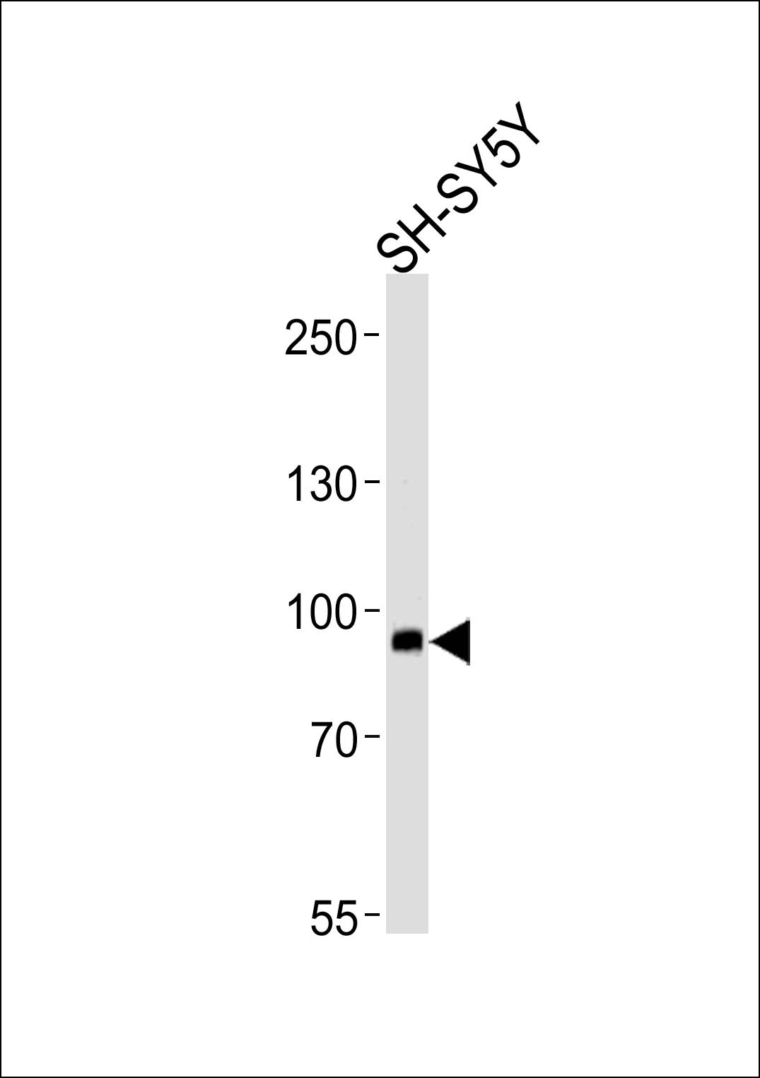 Western blot analysis of lysates from SH-SY5Y cell line (from left to right),using PLA2G4E Antibody(C15307). C15307 was diluted at 1:1000 at each lane. A goat anti-rabbit IgG H&L(HRP) at 1:5000 dilution was used as the secondary antibody.Lysates at 35ug per lane.