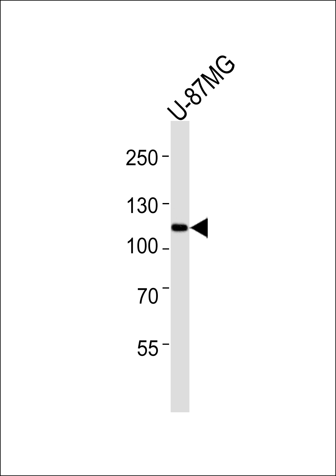 Western blot analysis of lysates from U-87 MG cell line (from left to right),using ADCY6 Antibody(C12035). C12035 was diluted at 1:1000 at each lane. A goat anti-rabbit IgG H&L(HRP) at 1:5000 dilution was used as the secondary antibody.Lysates at 35ug per lane.