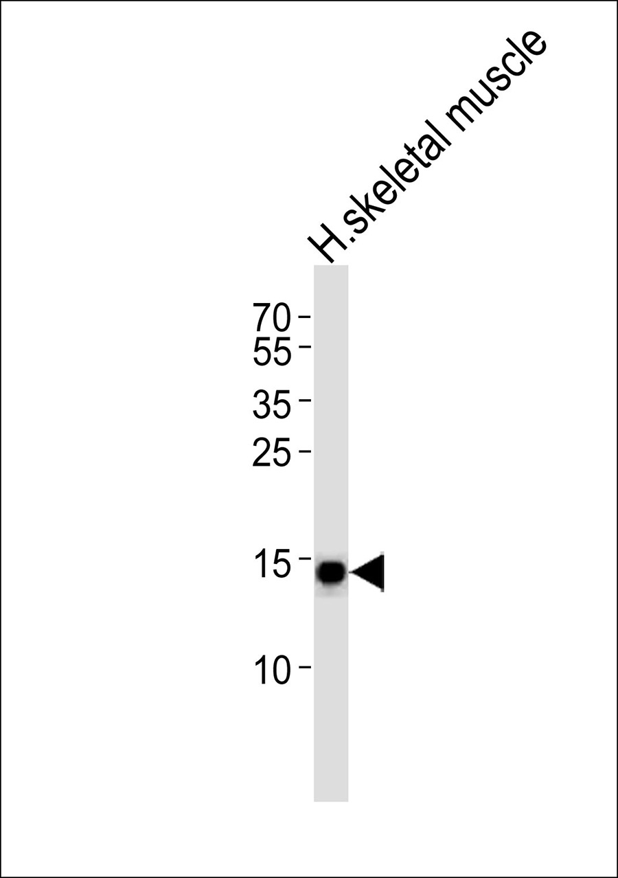 Western blot analysis of lysate from human skeletal muscle tissue lysate,using COX42 Antibody(AP50659). AP50659 was diluted at 1:1000. A goat anti-rabbit IgG H&L(HRP) at 1:5000 dilution was used as the secondary antibody.Lysate at 35ug.