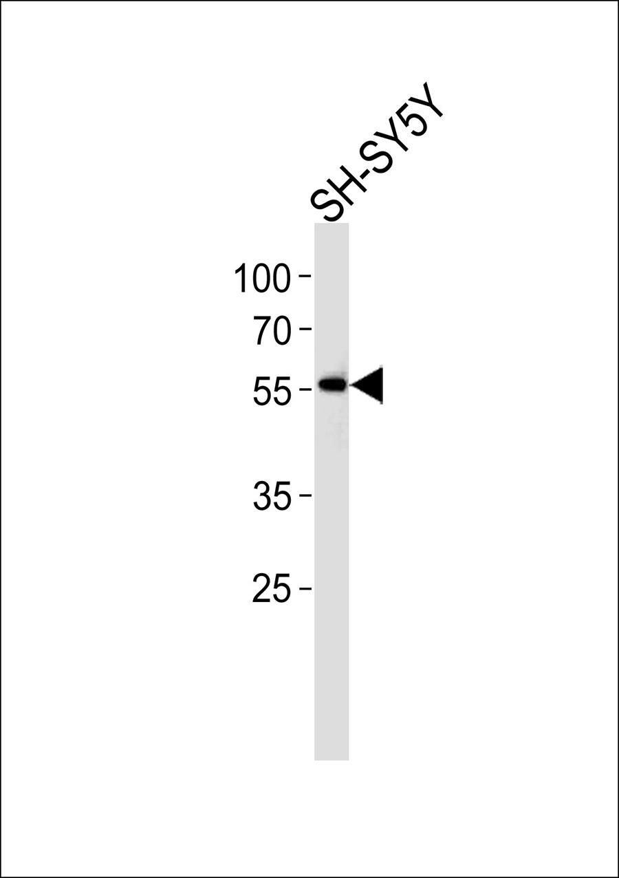 Western blot analysis of lysate from SH-SY5Y cell line,using NBPF7 Antibody(AP50656). AP50656 was diluted at 1:500. A goat anti-rabbit IgG H&L(HRP) at 1:5000 dilution was used as the secondary antibody.Lysate at 35ug.