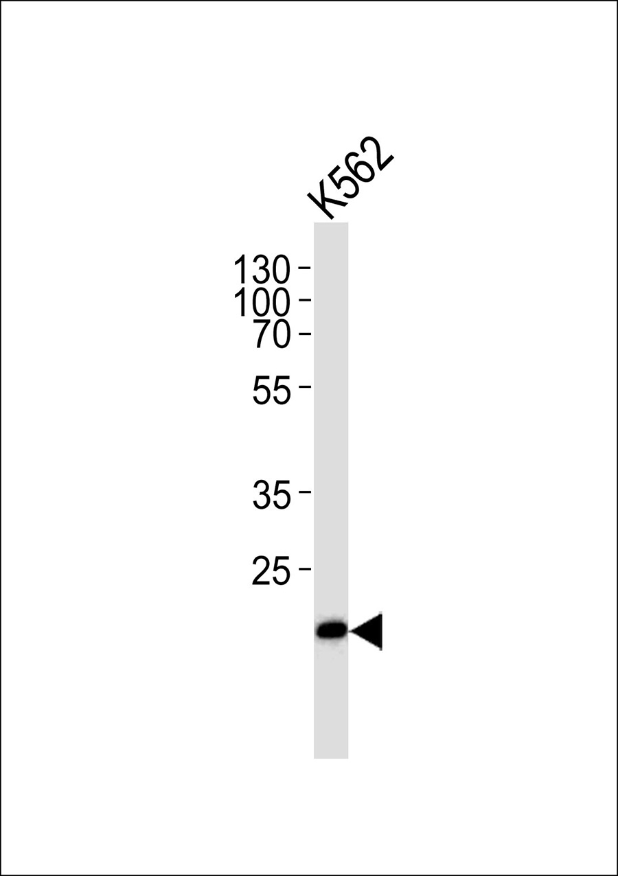 Western blot analysis of lysate from K562 cell line,using THAP4 Antibody(AP50652). AP50652 was diluted at 1:1000. A goat anti-rabbit IgG H&L(HRP) at 1:5000 dilution was used as the secondary antibody.Lysate at 35ug.