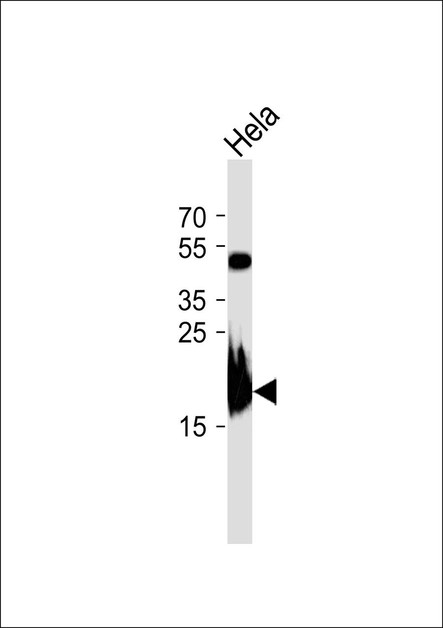 Western blot analysis of lysate from Hela cell line,using MRPL13 Antibody(AP50632). AP50632 was diluted at 1:1000. A goat anti-rabbit IgG H&L(HRP) at 1:5000 dilution was used as the secondary antibody.Lysate at 35ug.