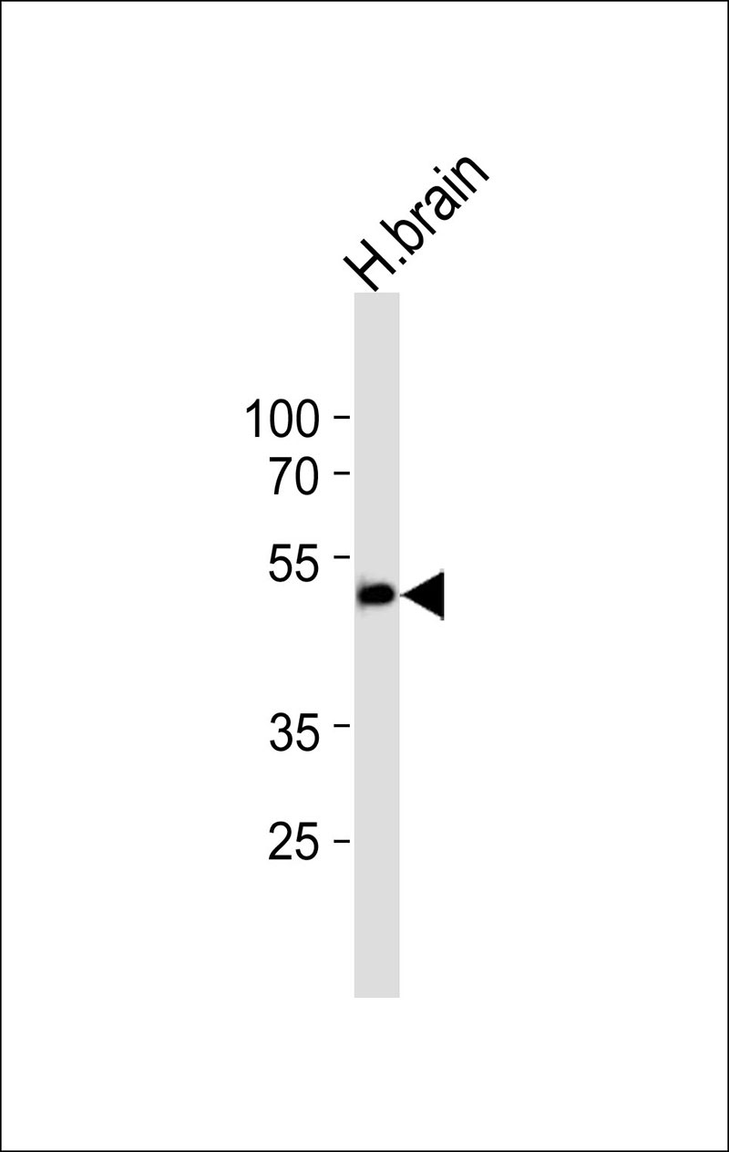 Western blot analysis of lysate from human brain tissue lysate,using CHST10 Antibody(AP50588). AP50588 was diluted at 1:1000. A goat anti-rabbit IgG H&L(HRP) at 1:5000 dilution was used as the secondary antibody.Lysate at 35ug.