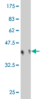 Antibody Reactive Against Recombinant Protein.Western Blot detection against Immunogen (36.52 KDa) . 