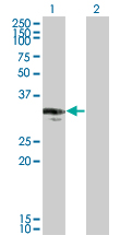 Western Blot analysis of CENPP expression in transfected 293T cell line by CENPP monoclonal antibody (M07), clone 3G8.Lane 1: CENPP transfected lysate(33.165 KDa).Lane 2: Non-transfected lysate.