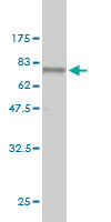 Antibody Reactive Against Recombinant Protein.Western Blot detection against Immunogen (77.99 KDa) .