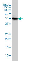 RNU3IP2 monoclonal antibody (M01), clone 1E8 Western Blot analysis of RNU3IP2 expression in Jurkat ( (Cat # AT3682a )