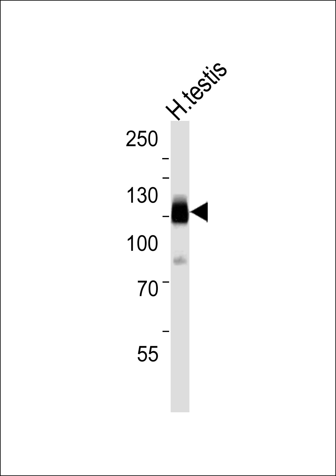 Western blot analysis of lysate from human testis tissue lysate,using CABYR Antibody was diluted at 1:1000. A goat anti-rabbit IgG H&L(HRP) at 1:5000 dilution was used as the secondary antibody.Lysate at 35ug.