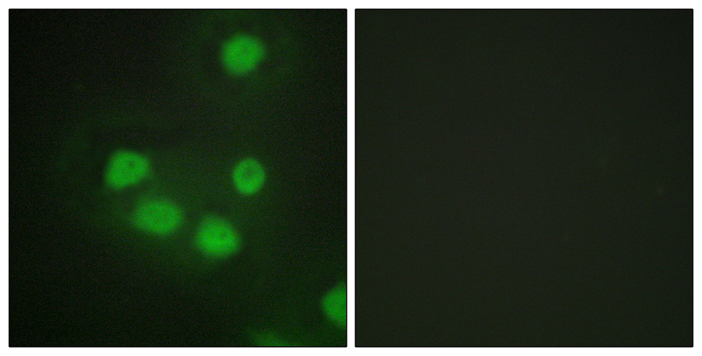 Immunofluorescence analysis of HepG2 cells, using SIX6 antibody.