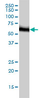 RNMT monoclonal antibody (M01), clone 3H3-1D12 Western Blot analysis of RNMT expression in HeLa ( (Cat # AT3679a )