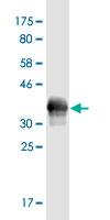 Western Blot detection against Immunogen (37.84 KDa)
