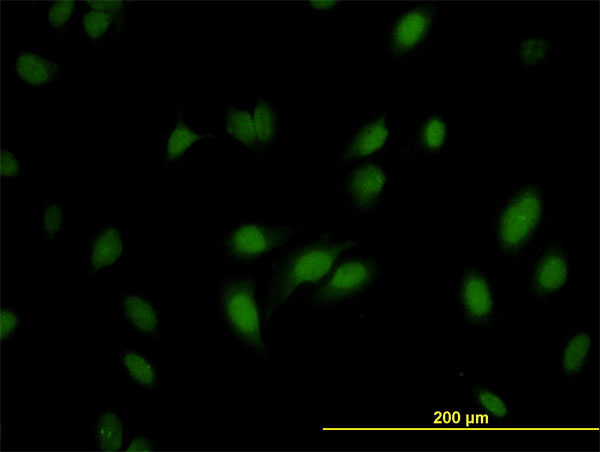 Immunofluorescence of monoclonal antibody to RNMT on HeLa cell. [antibody concentration 10 ug/ml]