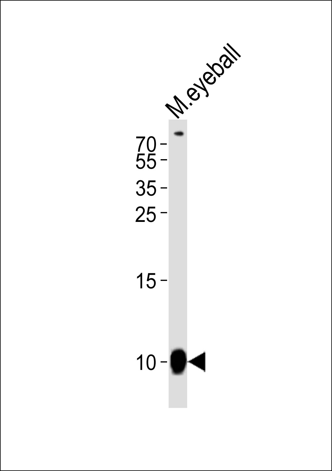 Western blot analysis of lysate from mouse eyeball tissue lysate, using GNGT1 Antibody (C-term)(Cat. #AP20634c). AP20634c was diluted at 1:1000. A goat anti-rabbit IgG H&L(HRP) at 1:5000 dilution was used as the secondary antibody. Lysate at 35ug.