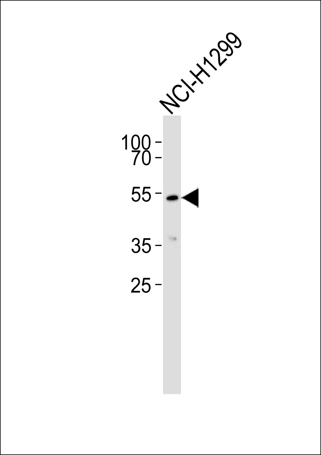 Western blot analysis of lysate from NCI-H1299 cell line,using ADCK1 Antibody(AP50794). AP50794 was diluted at 1:1000. A goat anti-rabbit IgG H&L(HRP) at 1:5000 dilution was used as the secondary antibody.Lysate at 35ug.