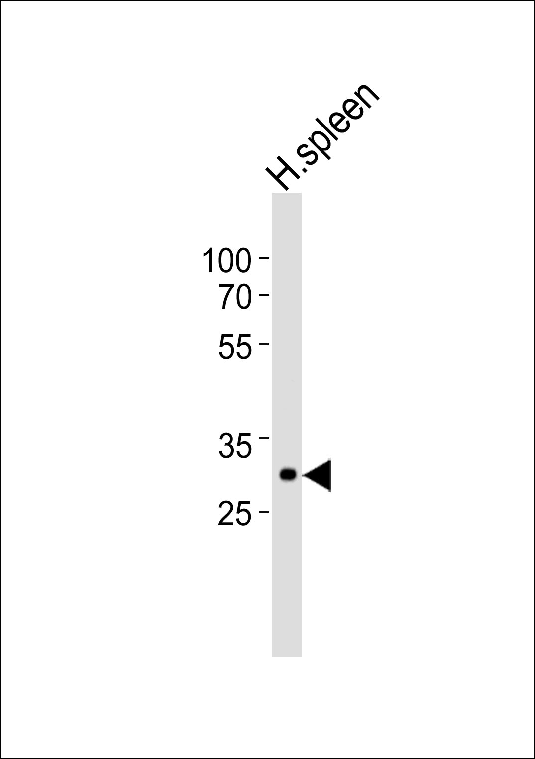 Western blot analysis of lysate from human spleen tissue lysate,using SPIC Antibody(AP50791). AP50791 was diluted at 1:1000. A goat anti-rabbit IgG H&L(HRP) at 1:5000 dilution was used as the secondary antibody.Lysate at 35ug.