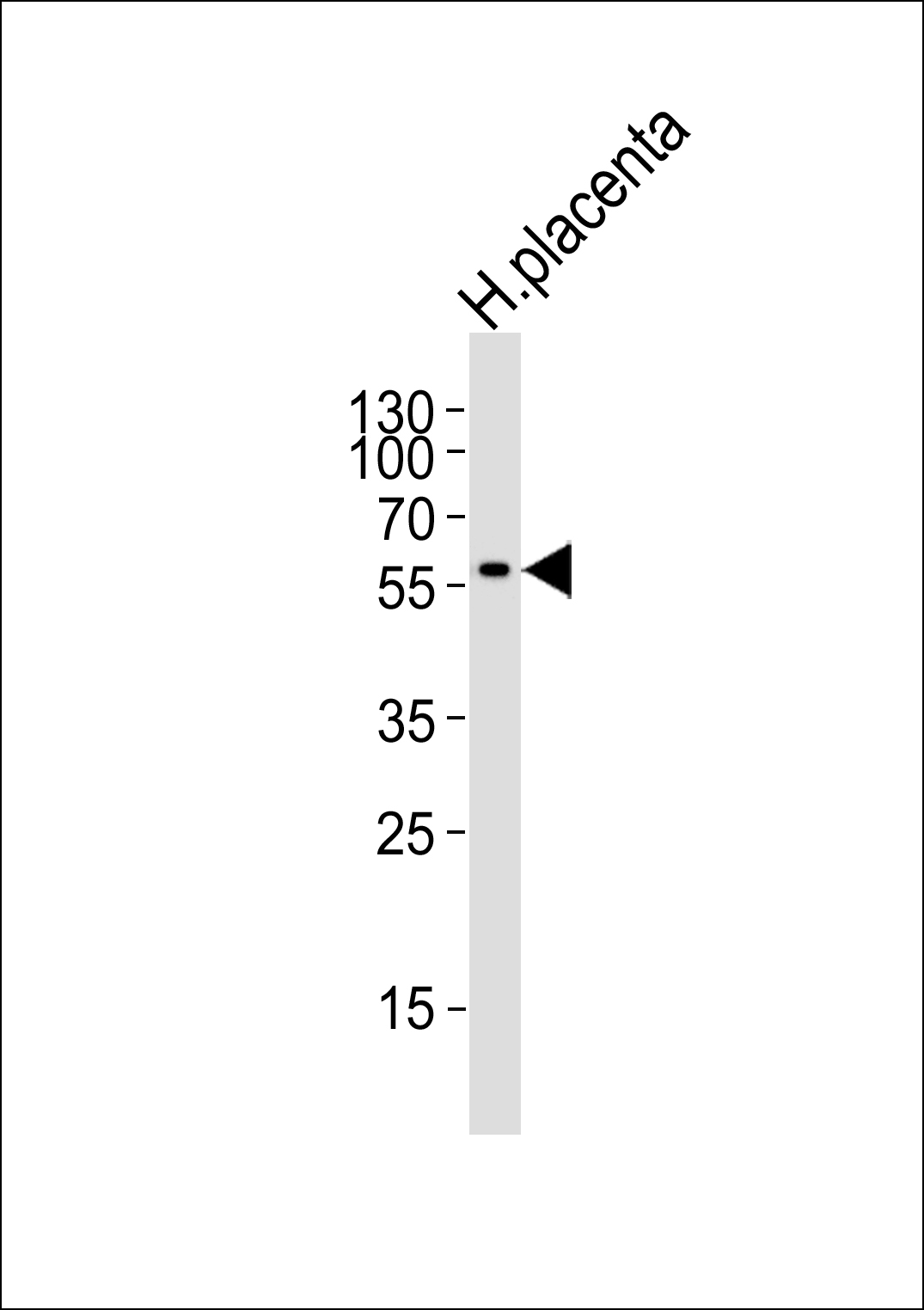 Western blot analysis of lysate from human placenta tissue lysate,using ASAH3L Antibody(AP50775). AP50775 was diluted at 1:1000. A goat anti-rabbit IgG H&L(HRP) at 1:5000 dilution was used as the secondary antibody.Lysate at 35ug.