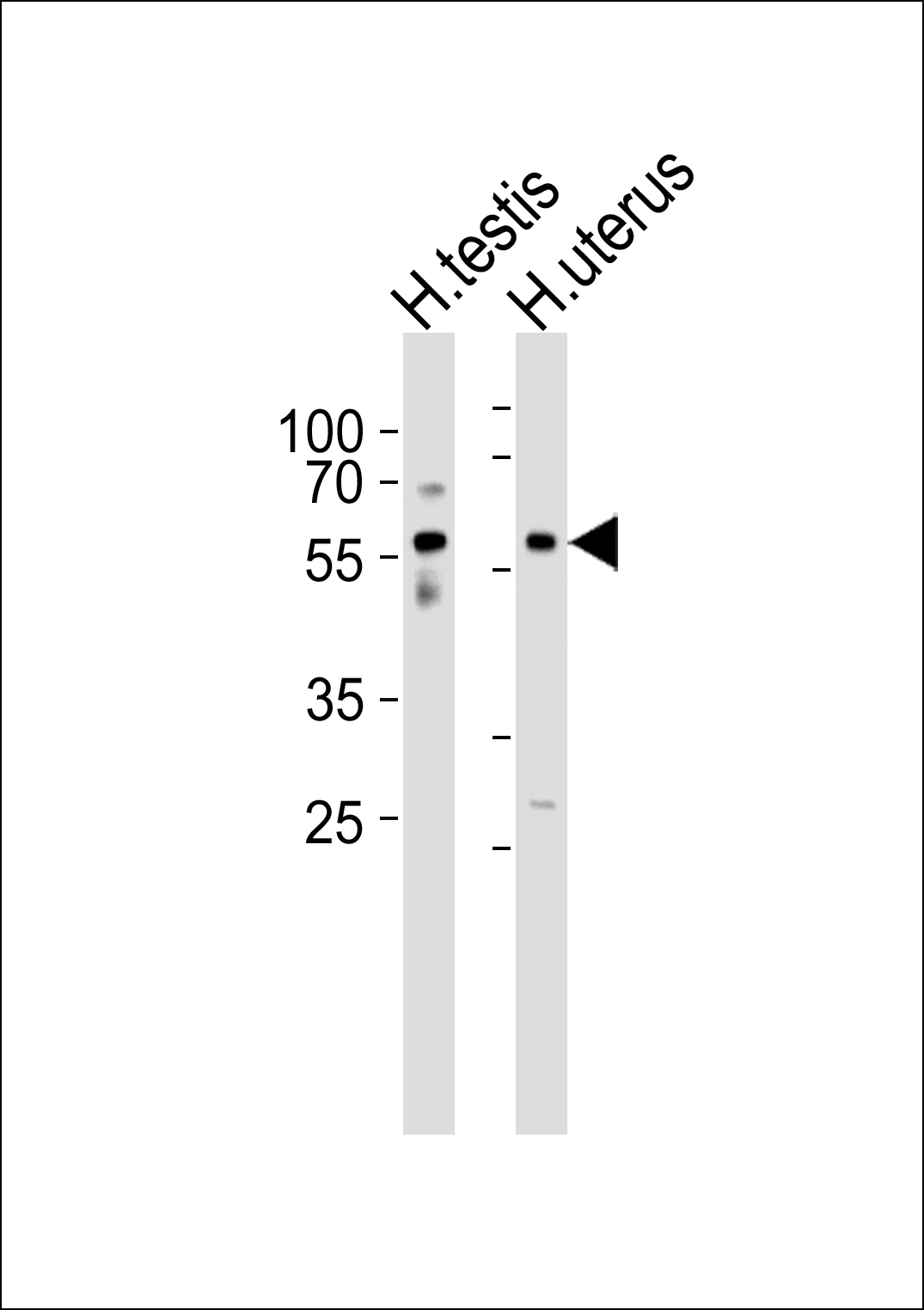 Western blot analysis of lysates from human testis and uterus tissue lysate(from left to right),using B3GALTL Antibody(AP50766). AP50766 was diluted at 1:1000 at each lane. A goat anti-rabbit IgG H&L(HRP) at 1:5000 dilution was used as the secondary antibody.Lysates at 35ug per lane.