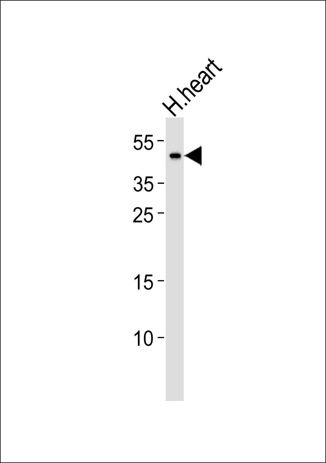 Western blot analysis of lysate from human heart tissue lysate,using NDUFV3 Antibody(AP50747). AP50747 was diluted at 1:1000. A goat anti-rabbit IgG H&L(HRP) at 1:5000 dilution was used as the secondary antibody.Lysate at 35ug.