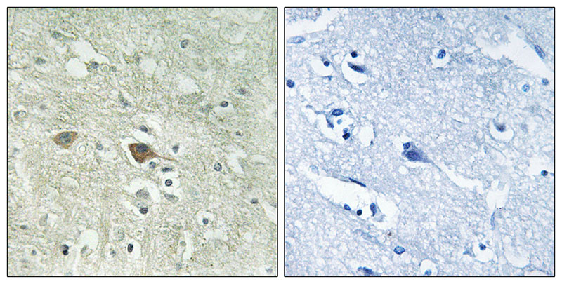 Immunohistochemistry analysis of paraffin-embedded human brain tissue using NDUFV3 antibody.