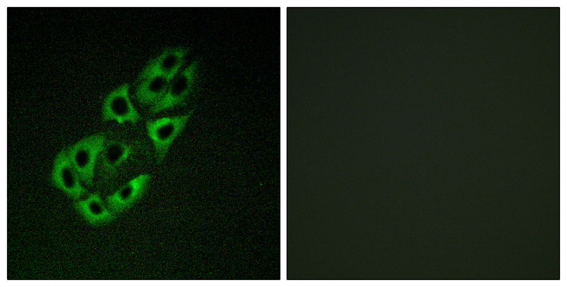 Immunofluorescence analysis of A549 cells, using MtSSB antibody.