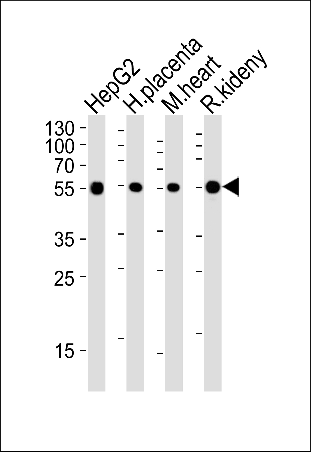 Western blot analysis of lysates from HepG2 cell line ,human placenta,mouse heart and rat kideny tissue lysate(from left to right),using MYLIP Antibody (Center)(AP50758). AP50758 was diluted at 1:1000 at each lane. A goat anti-rabbit IgG H&L(HRP) at 1:5000 dilution was used as the secondary antibody.Lysates at 35ug per lane.
