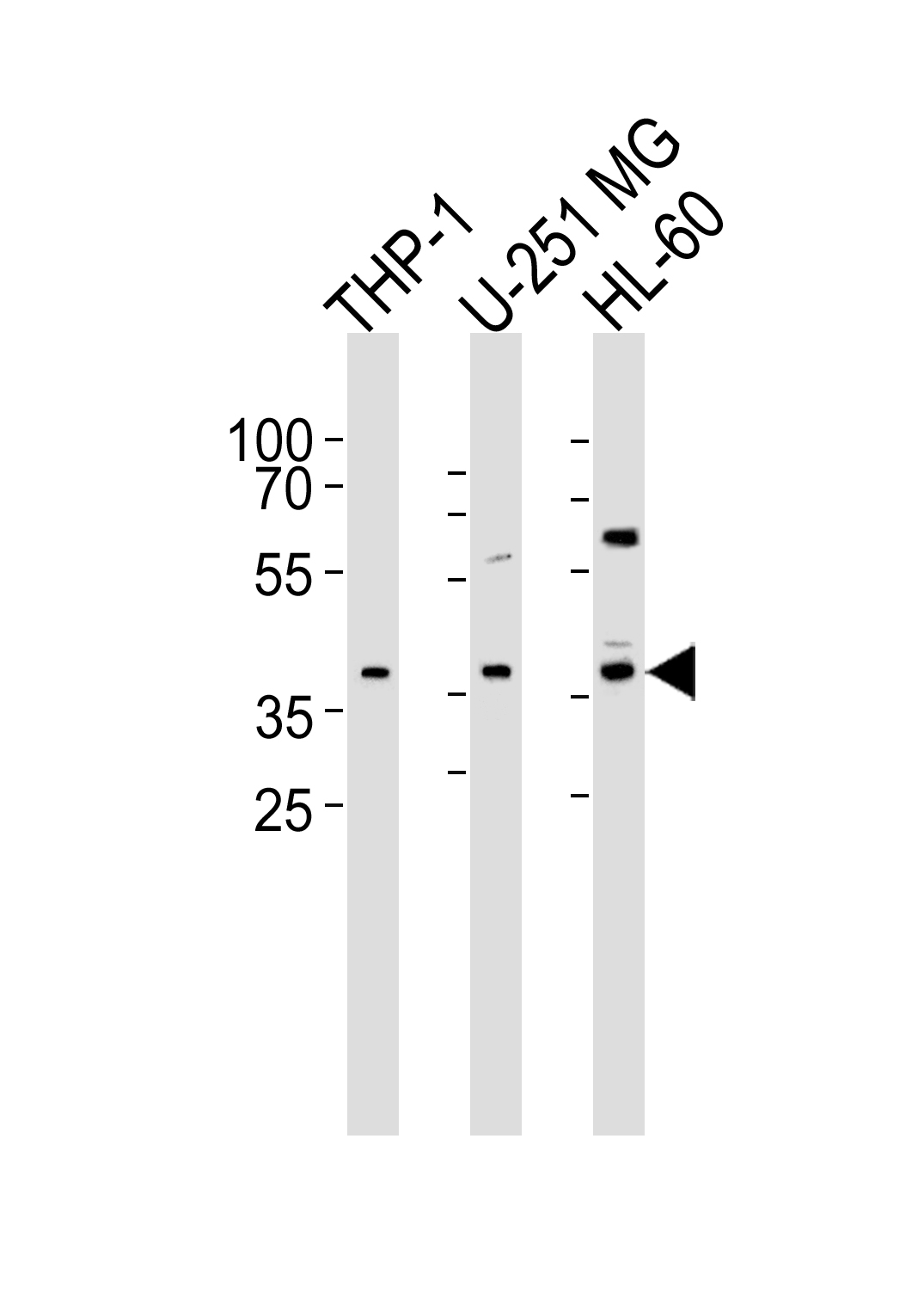 Western blot analysis of lysates from THP-1, U-251 MG, HL-60 cell line (from left to right), using RAD9B Antibody (C-term)(Cat. #AP20632c). AP20632c was diluted at 1:1000 at each lane. A goat anti-rabbit IgG H&L(HRP) at 1:5000 dilution was used as the secondary antibody. Lysates at 35ug per lane.