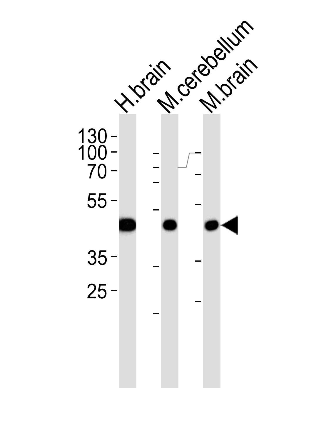 Western blot analysis of lysates from human brain, mouse cerebellum and mouse brain tissue lysate (from left to right), using GABRG1 Antibody (C-term)(Cat. #AP20691c). AP20691c was diluted at 1:1000 at each lane. A goat anti-rabbit IgG H&L(HRP) at 1:5000 dilution was used as the secondary antibody. Lysates at 35ug per lane.